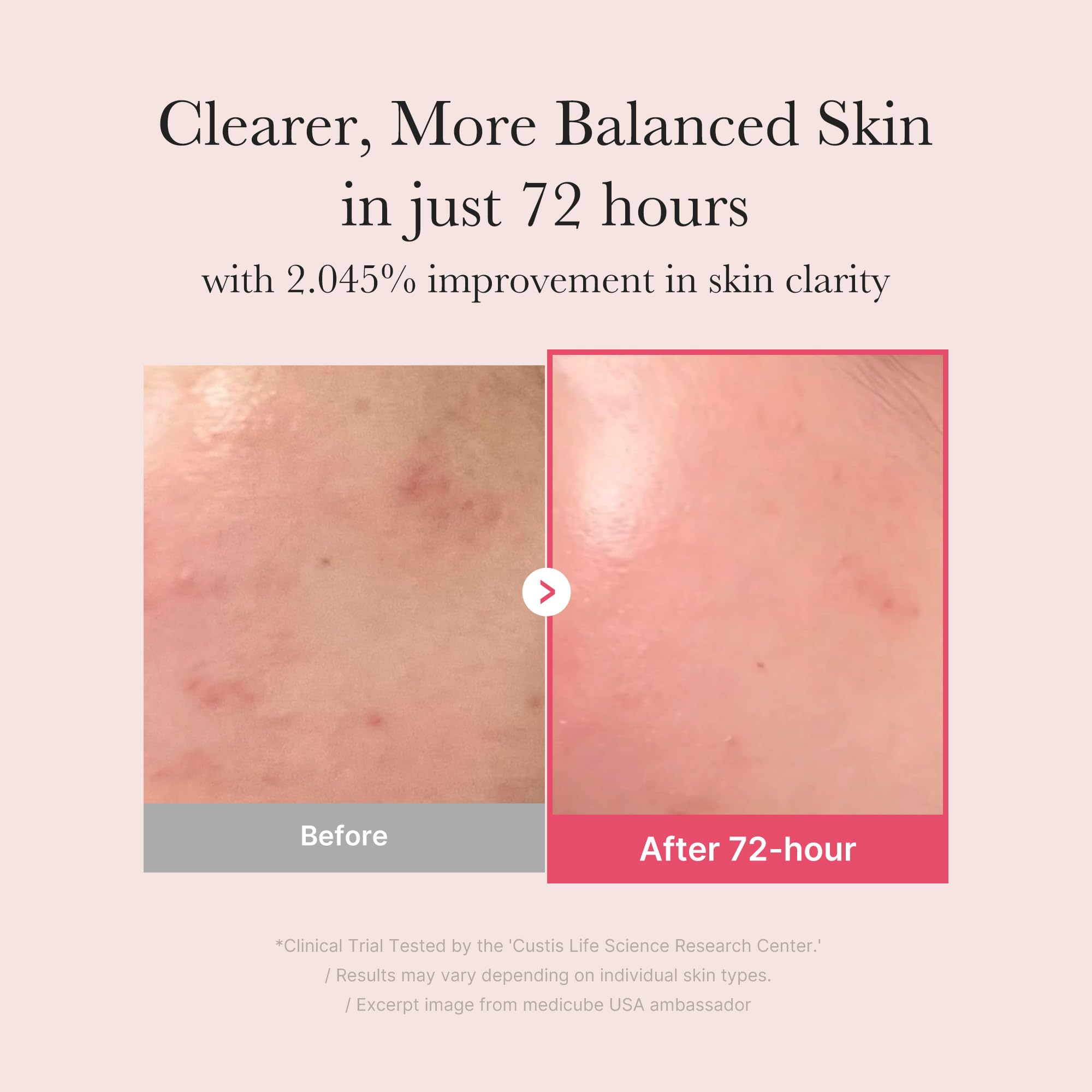 Medicube TXA Niacinamide 15 Serum